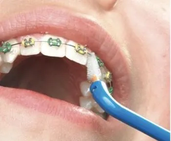 CURAPROX ORTHO CARE KIT